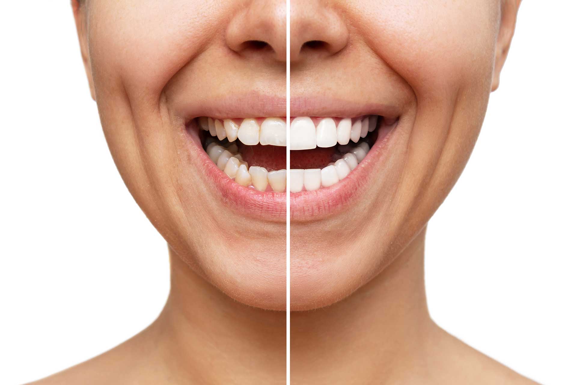 Ästhetische Zahnmedizin 1