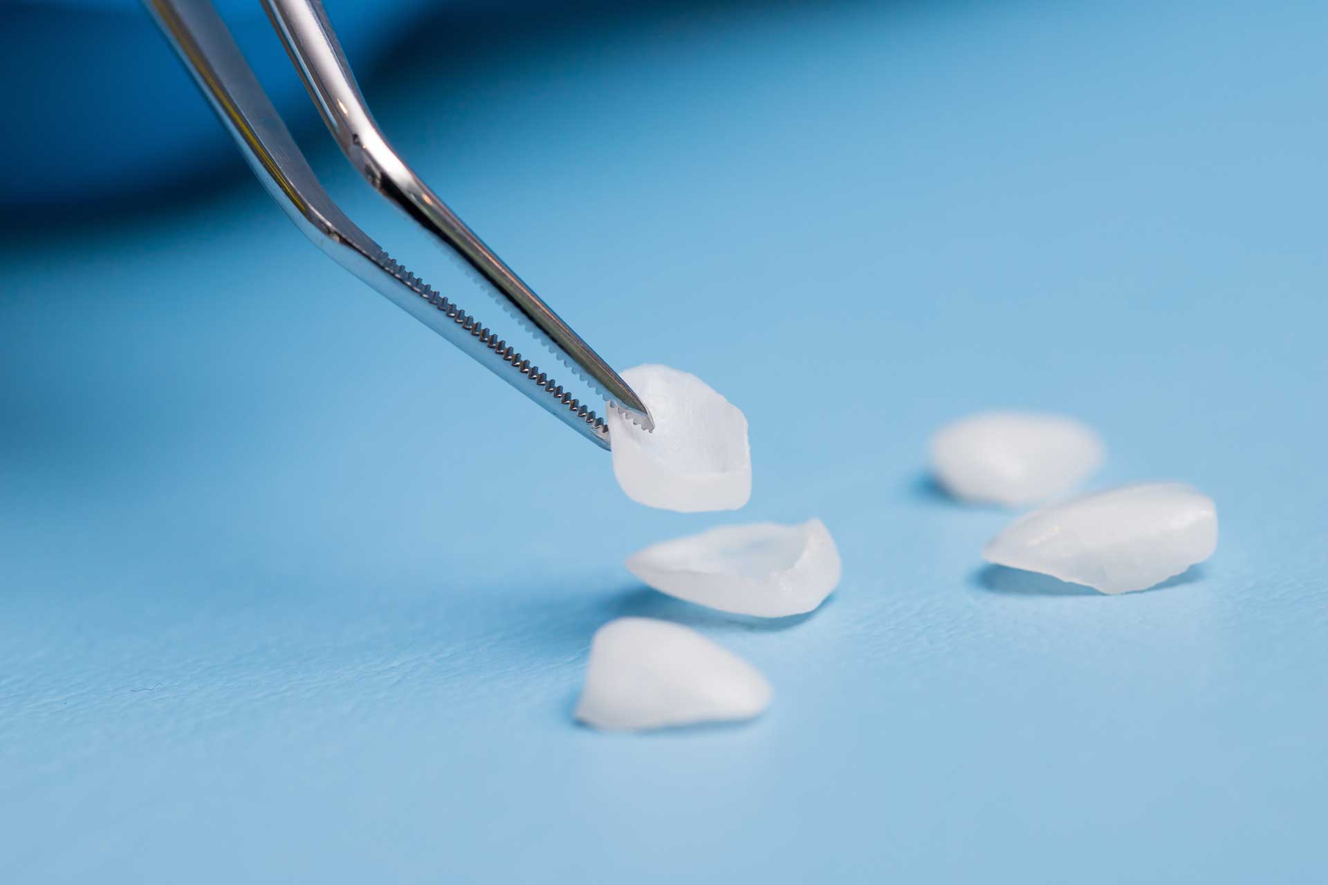 Ästhetische Zahnmedizin 2