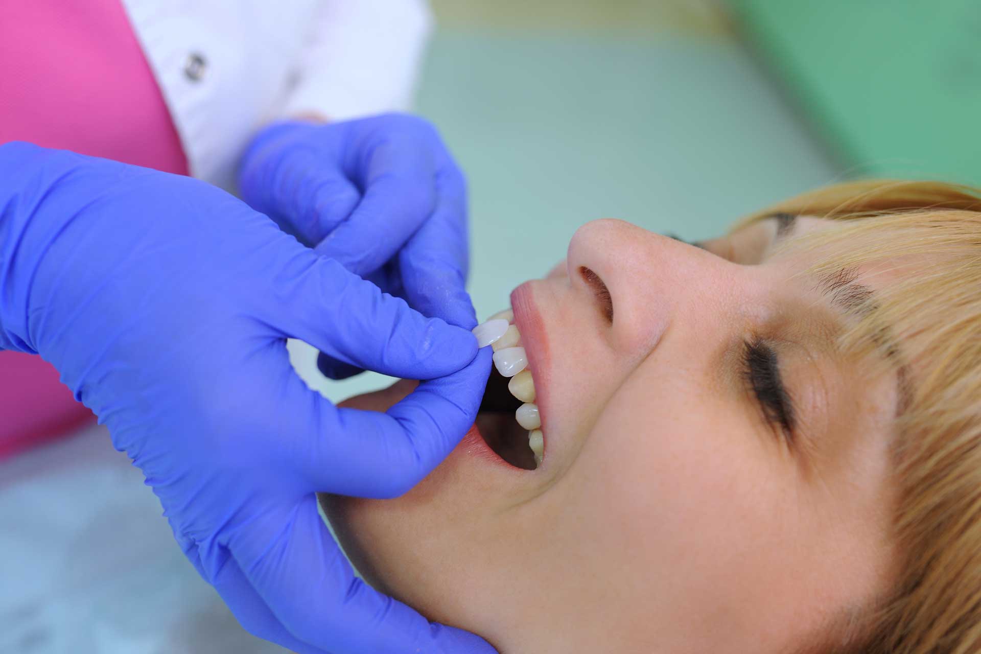 Ästhetische Zahnmedizin 3