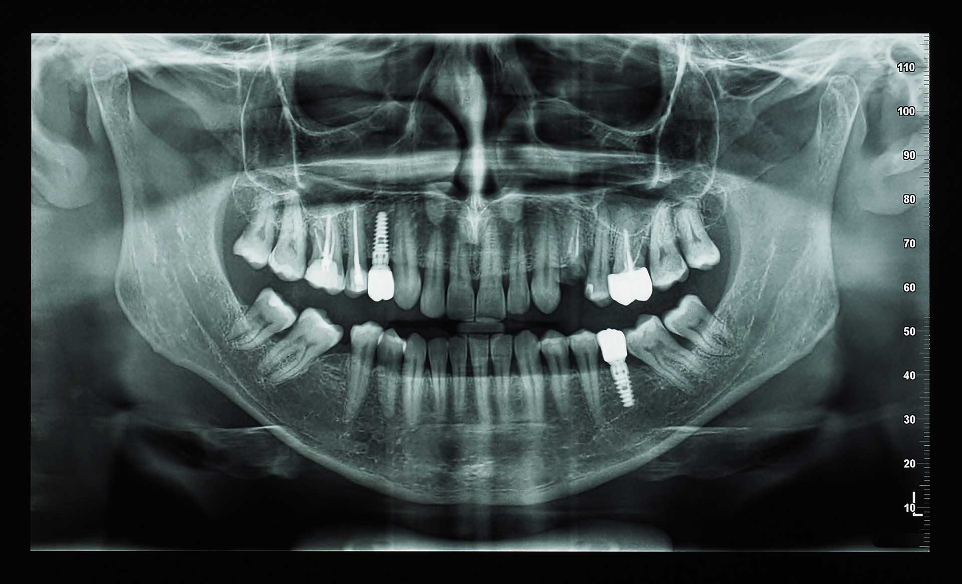 Oralchirurgie 2